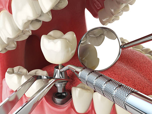 Best Walk-In Emergency Dentist in Monterey Park, CA